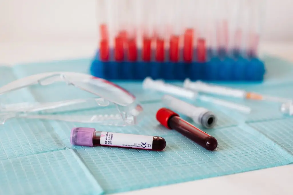 Test tubes of blood in a lab